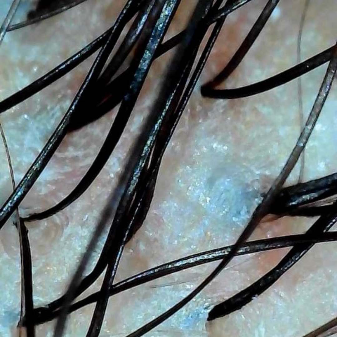 Hydrated and nourished scalp after treatment at DesCurl Spa Salon.